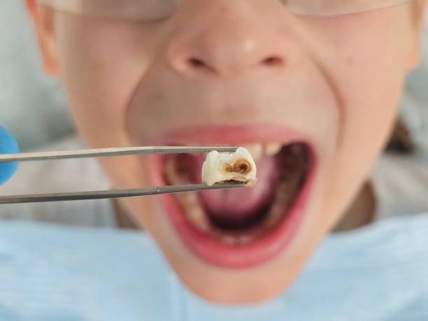 Best Emergency Denture Repair in Mooreland, OK